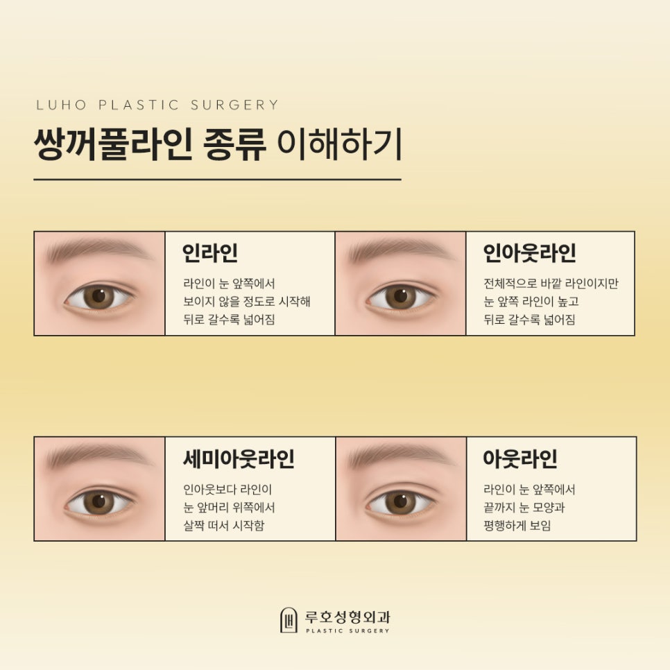 How Double Eyelid Surgery at Sinsa Station Changed the Appearance of the Eyes: A Look at Before-and-After Photos image 2
