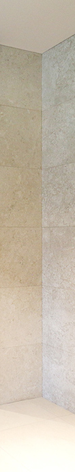 What Are the Key Points Before and After Eyelid Correction at Apgujeong Station? image 12