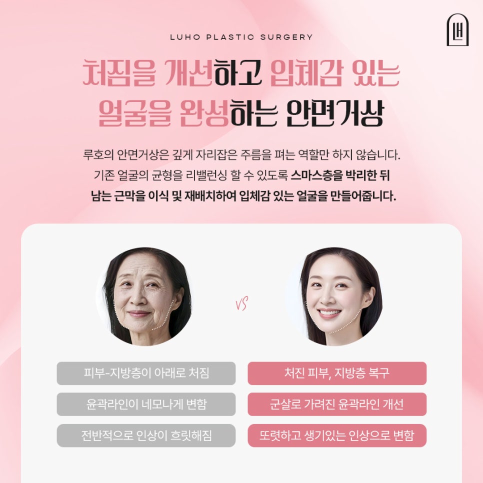 A Case of Facelift Surgery at Sinsa Station That Restored Weakened Midface Support image 4