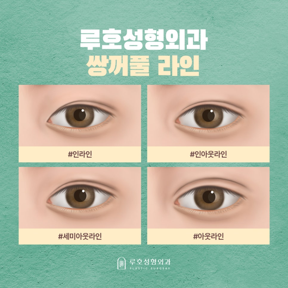 인아웃라인 쌍꺼풀, 나에게도 어울리게 만들려면 관련 이미지 2