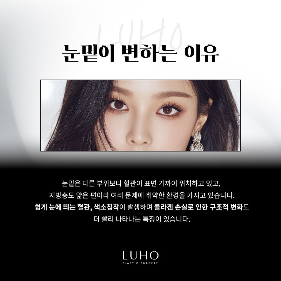 Reduce Deep Dark Circles and Brighten the Eye Area with Under-Eye Fat Repositioning at Sinsa Station image 2
