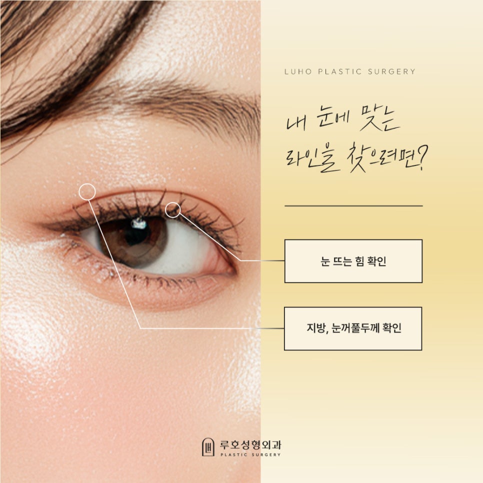 How Double Eyelid Surgery at Sinsa Station Changed the Appearance of the Eyes: A Look at Before-and-After Photos image 3