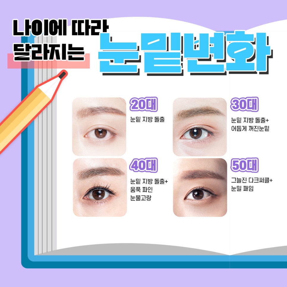 Lower Eyelid Fat Repositioning That Improves the Causes of a Tired Appearance image 3