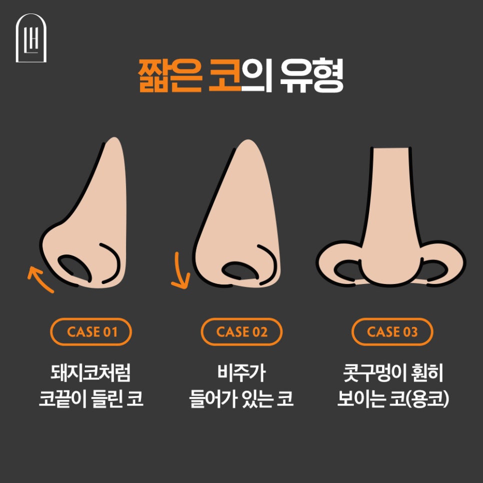 짧은코 들창코를 세련된 코로 관련 이미지 3