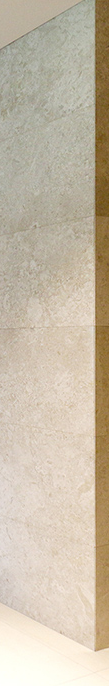 What Are the Key Points Before and After Eyelid Correction at Apgujeong Station? image 13