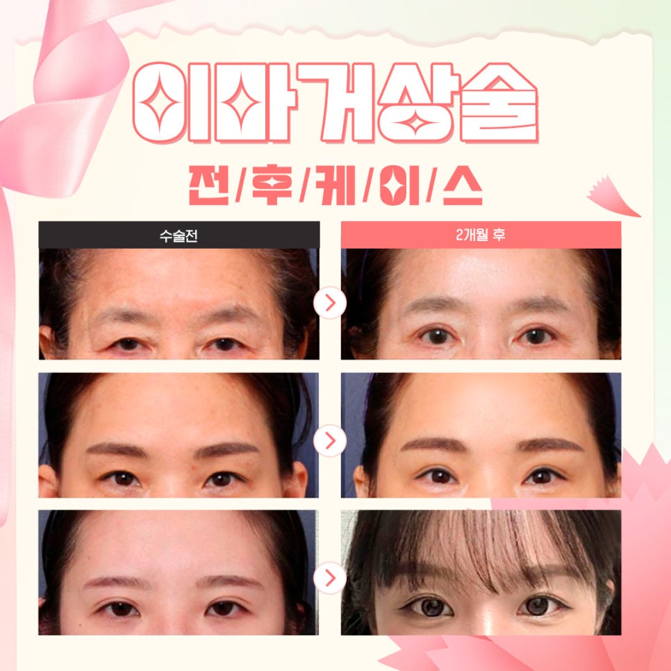 🌺루호성형외과 5월 가정의 달 효도 이벤트💐 관련 이미지 7