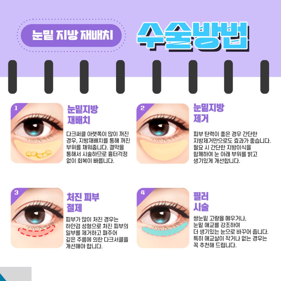 Lower Eyelid Fat Repositioning That Improves the Causes of a Tired Appearance image 4