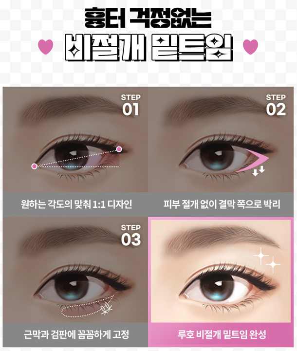 ［루호성형외과］부드럽고 청순한 눈매 관련 이미지 4