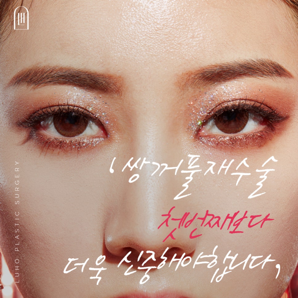 Double Eyelid Revision Surgery at Luho image 2