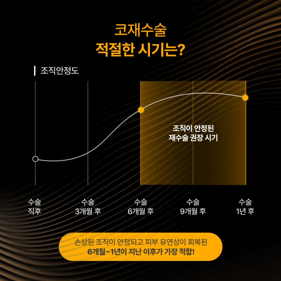 원인과 구조를 파악한 여자 코재수술 사례 살펴보기 관련 이미지 2