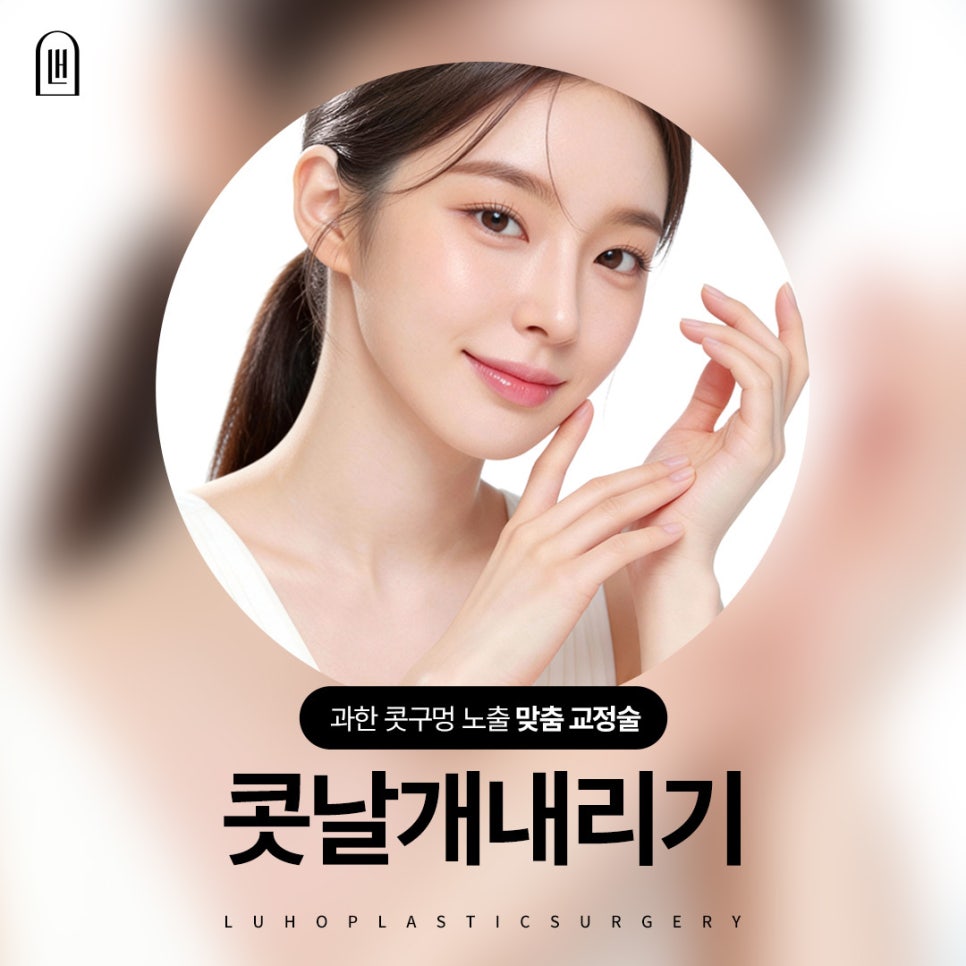 돼지코처럼 보이는 코, 신사역 콧날개내리기로 해결하기 관련 이미지 1