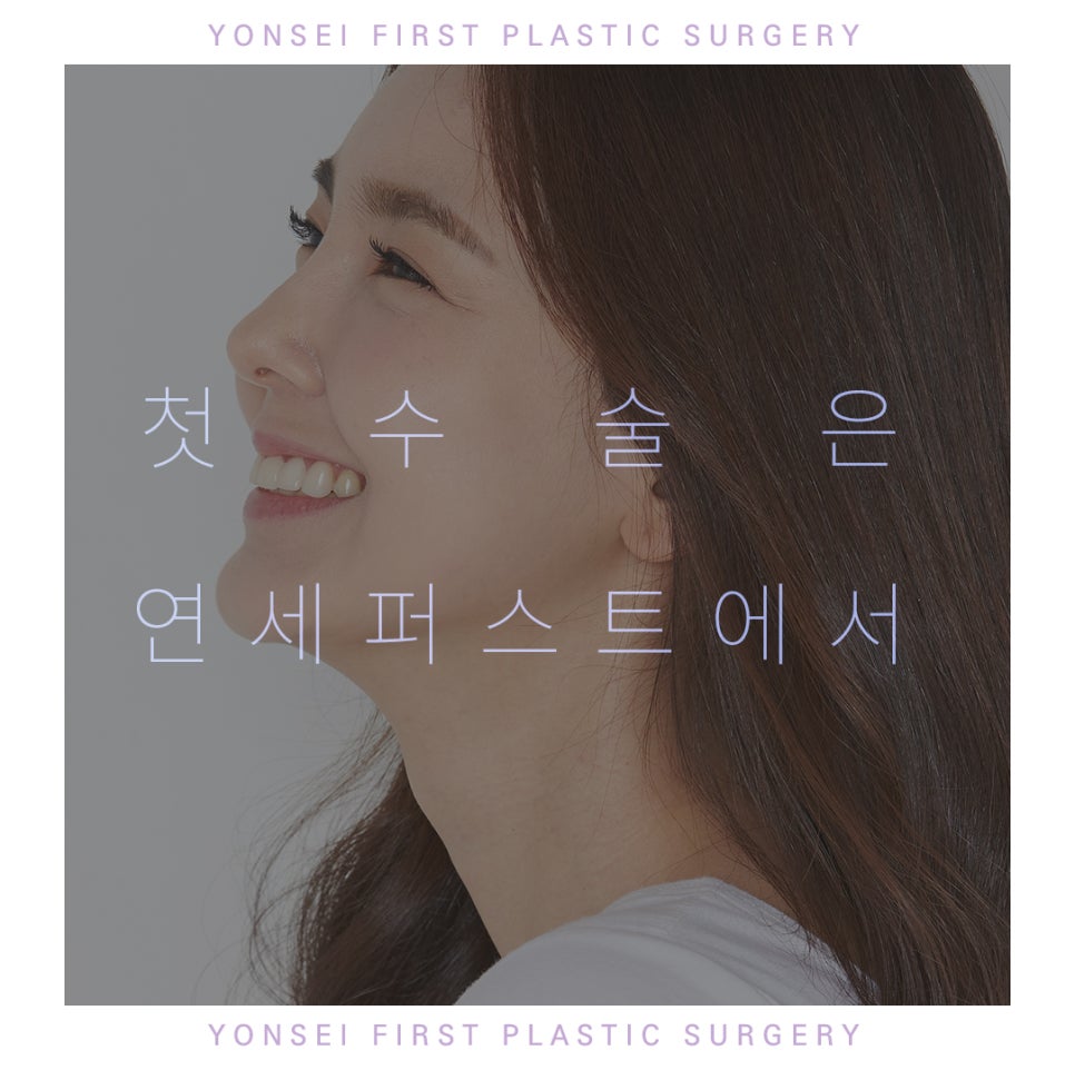눈성형 관련 이미지 3