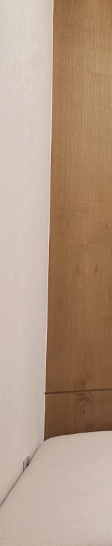 마리오네트 주름 해결한 신사역 안면거상술 효과 관련 이미지 6