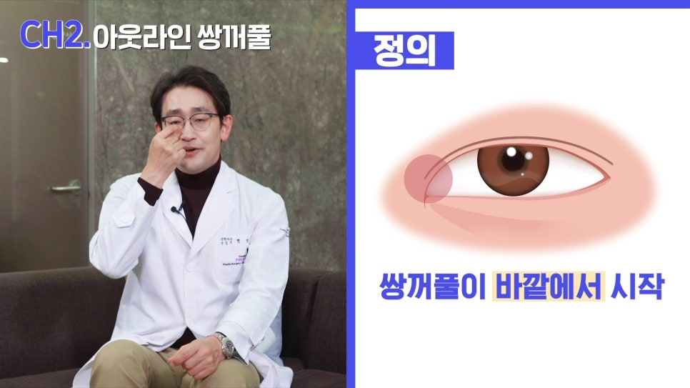 나에게 맞는 쌍커풀 라인은? - 아성원 관련 이미지 11