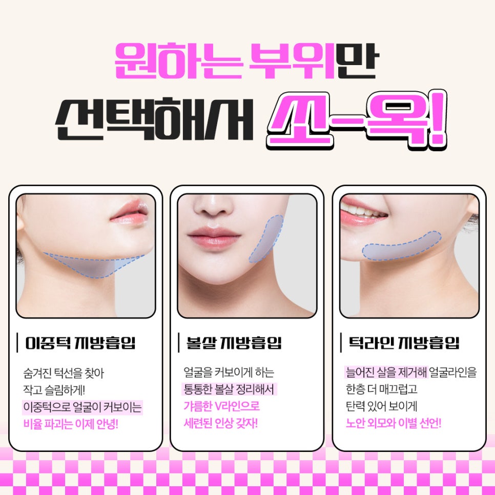 Large-Volume Facial Liposuction at Ruho Plastic Surgery image 3