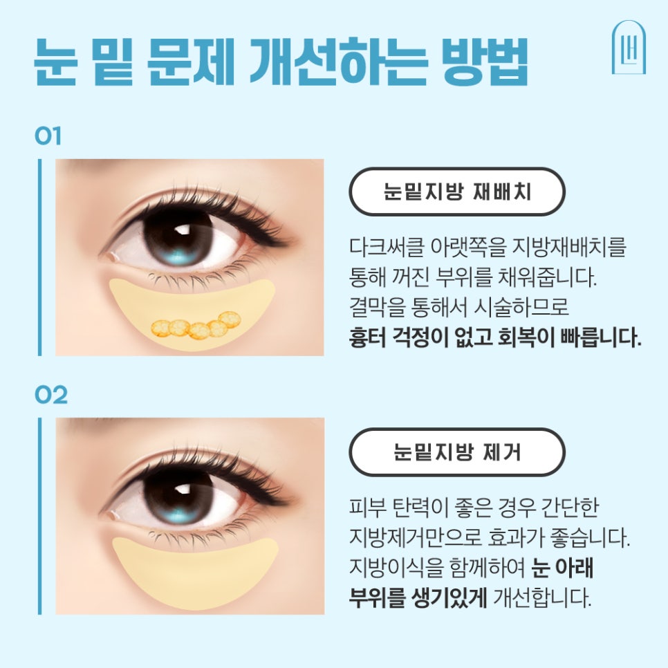 눈 밑 그늘 개선, 루호성형외과 눈밑지방재배치 관련 이미지 2