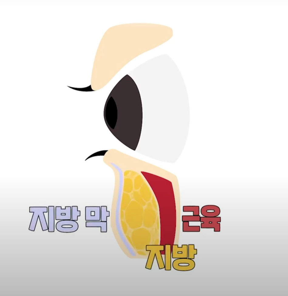 ［루호성형외과］어두운 눈 밑을 환하게-눈밑지방재배치 관련 이미지 3