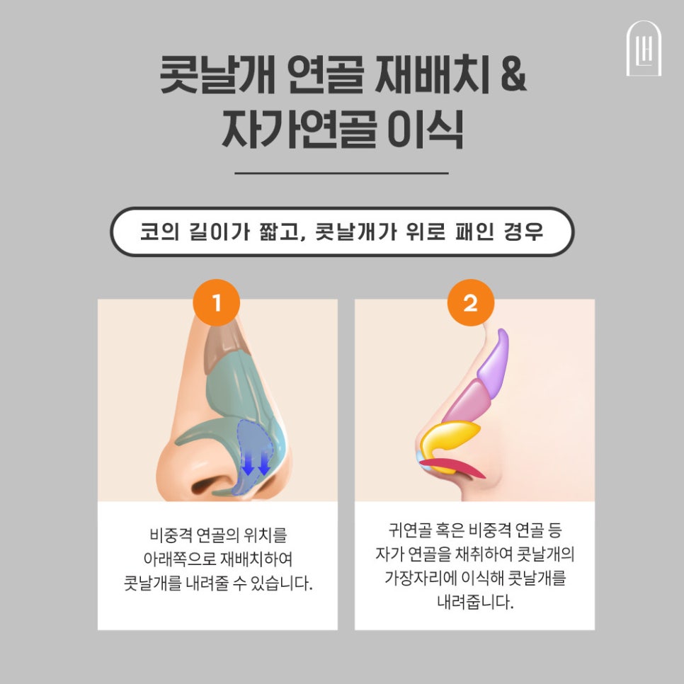 짧은코 들창코를 세련된 코로 관련 이미지 6