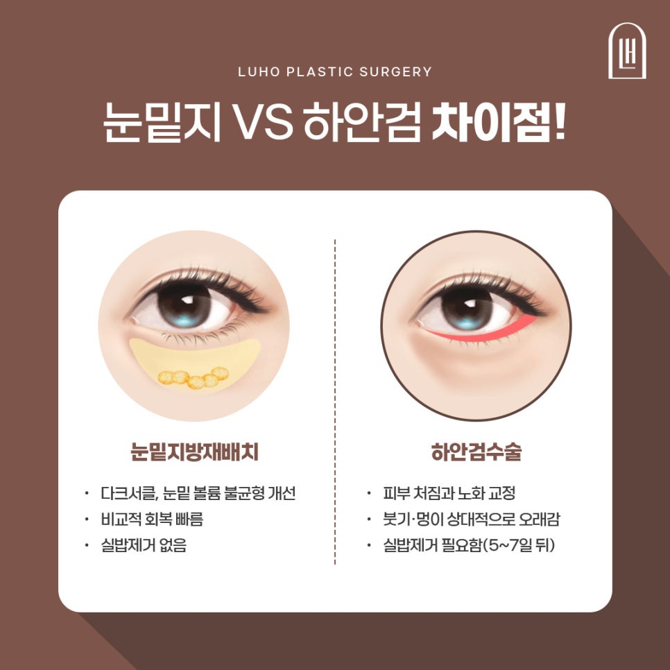 남자다크서클 고민, 신사역 눈밑지방재배치 후 경과 관련 이미지 4