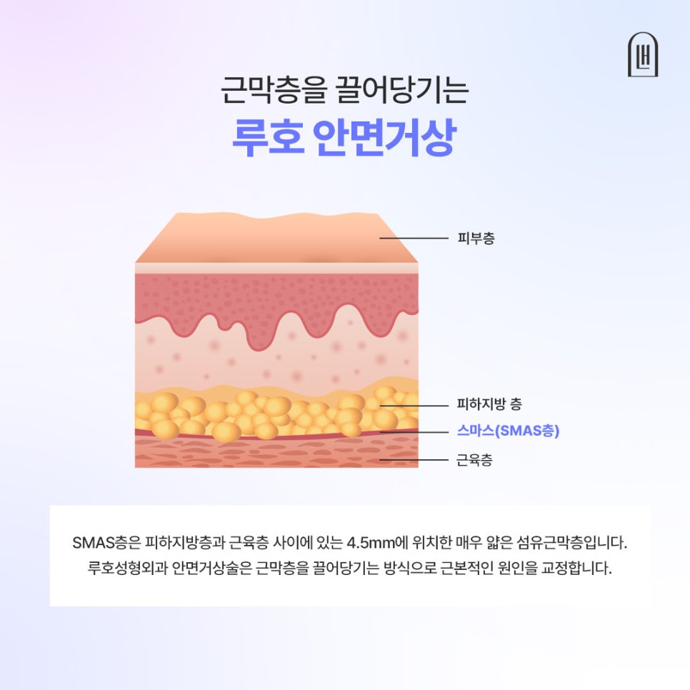 강남 신사역 안면거상술, 팔자주름 리프팅만으로 부족했던 이유 관련 이미지 4