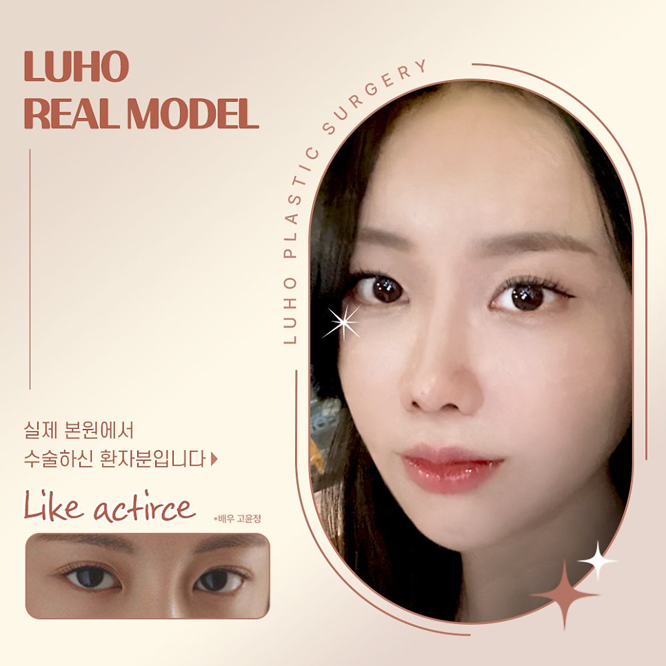 ［루호성형외과］2023년 인기있는 여자 연예인 눈 관련 이미지 2