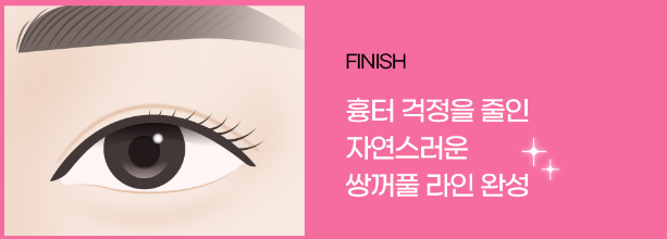 Ruho Plastic Surgery Natural Adhesion Eye Surgery image 5