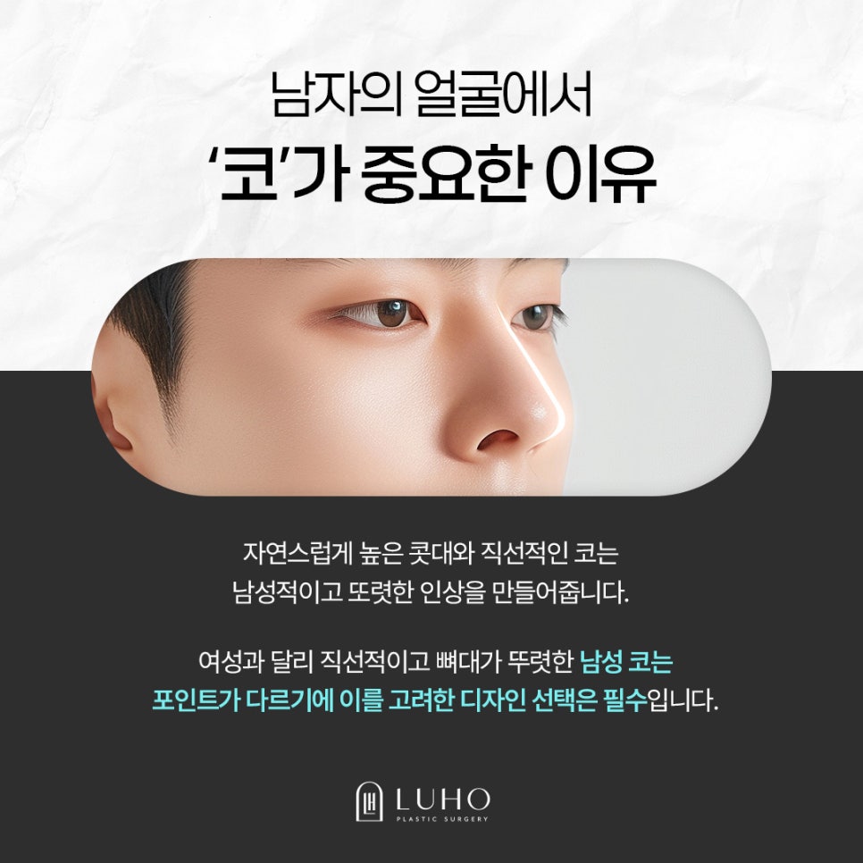 A Real Review of Men’s Rhinoplasty at Sinsa Station That Completed a Masculine Line image 2