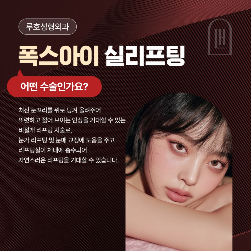 신사역 폭스아이실리프팅으로 처진 눈꼬리를 교정한 사례 관련 이미지 3