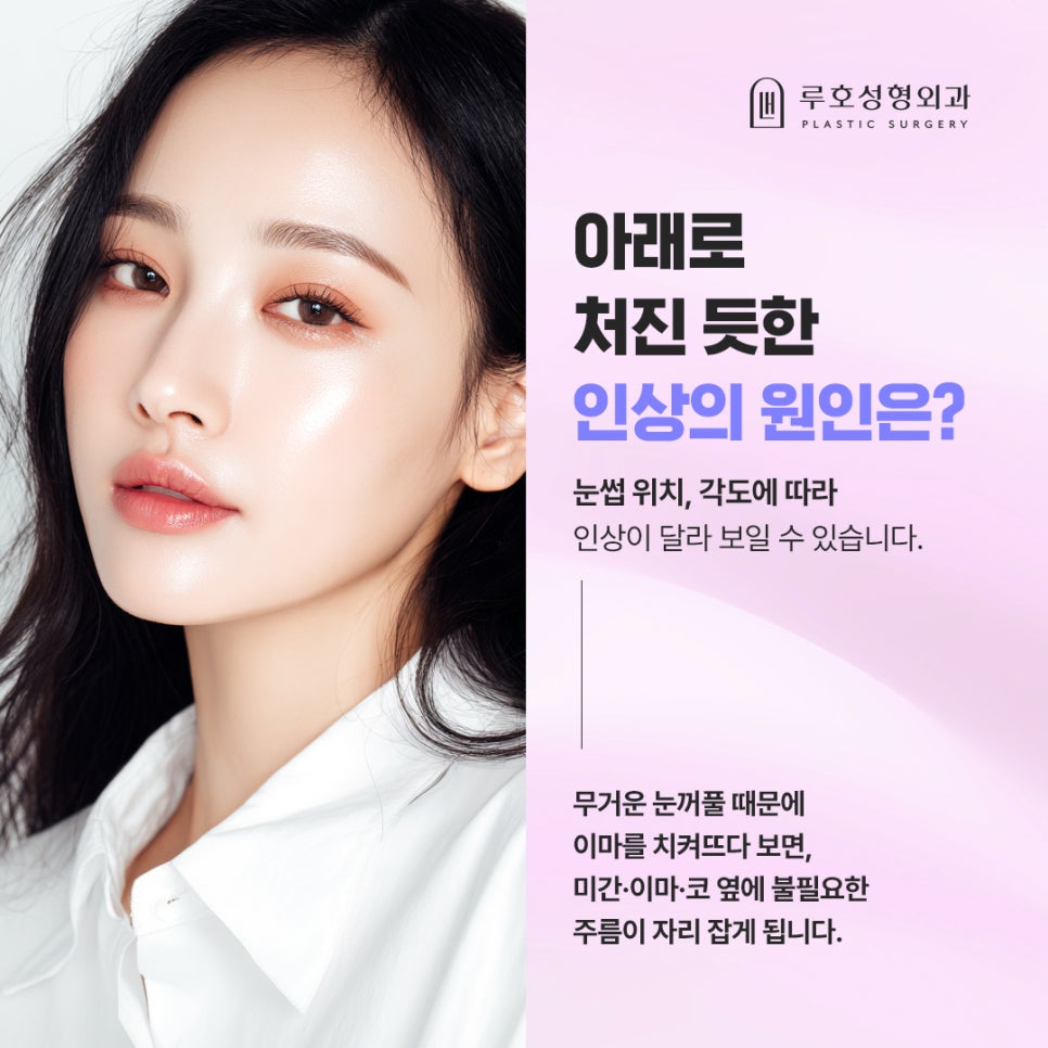 처진 눈썹 바꿔놓은 신사역 이마거상 후기 관련 이미지 3