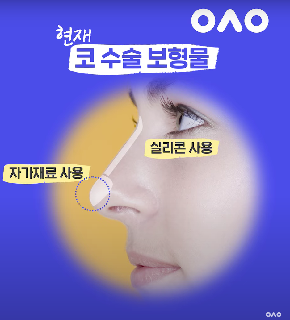 Too Many Nose Surgery Rumors π±π± How Much of It Is True?! image 3