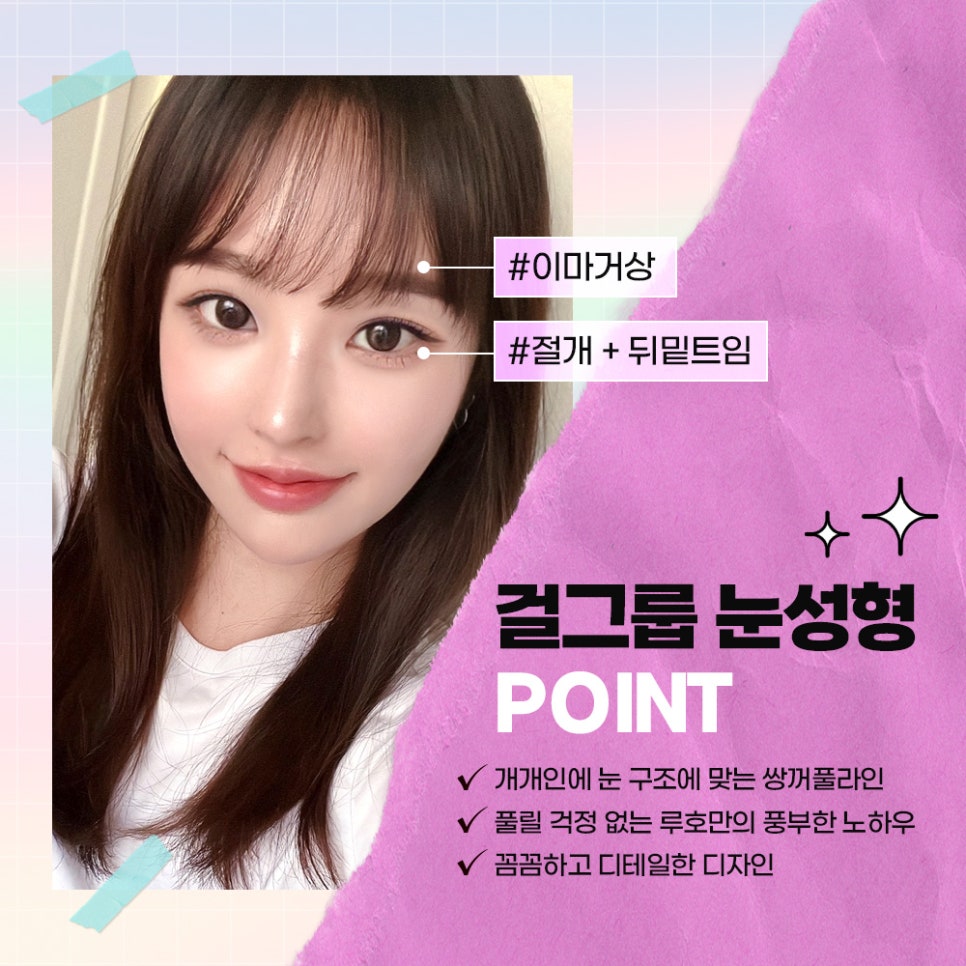 ［Luho Plastic Surgery］The HOT Girl Group Eyes of Today image 3