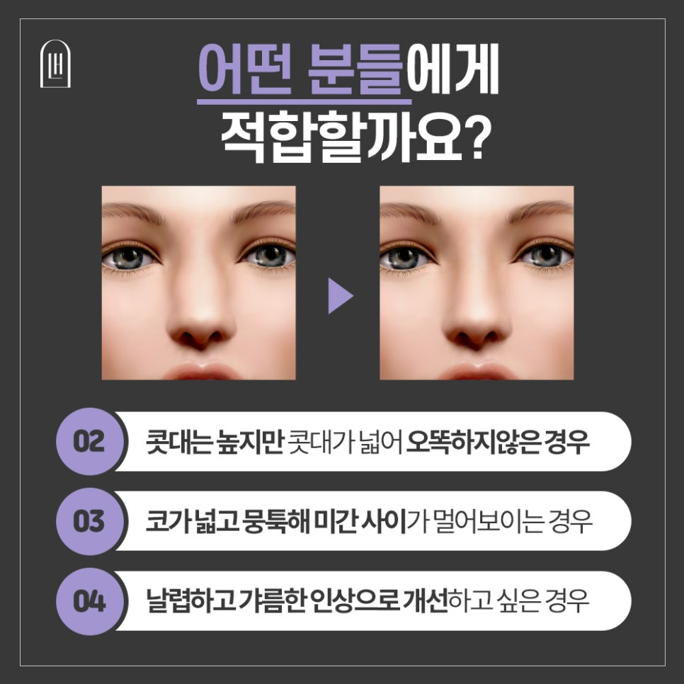 넓은 콧대,이제는 슬림하고 세련되게! 관련 이미지 3