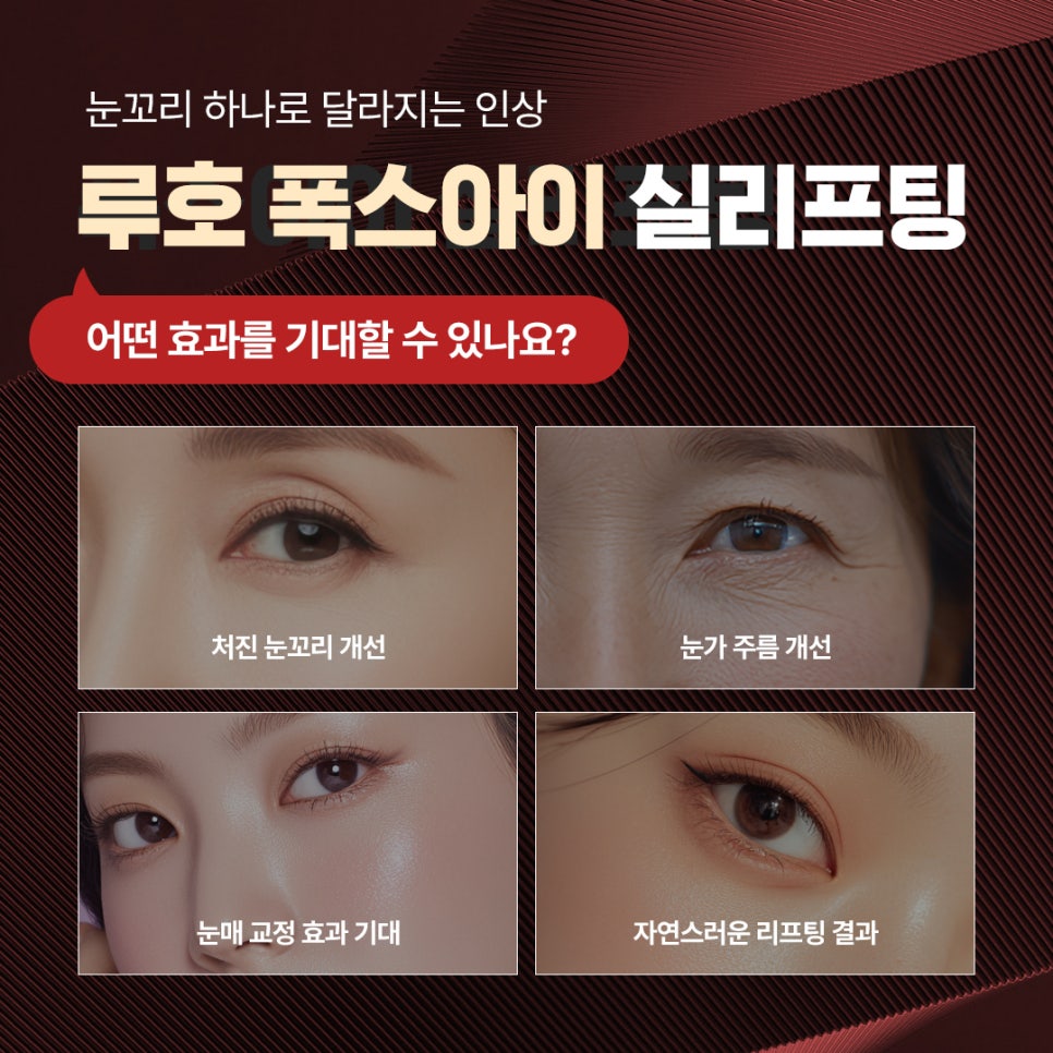 신사역 폭스아이실리프팅으로 처진 눈꼬리를 교정한 사례 관련 이미지 4