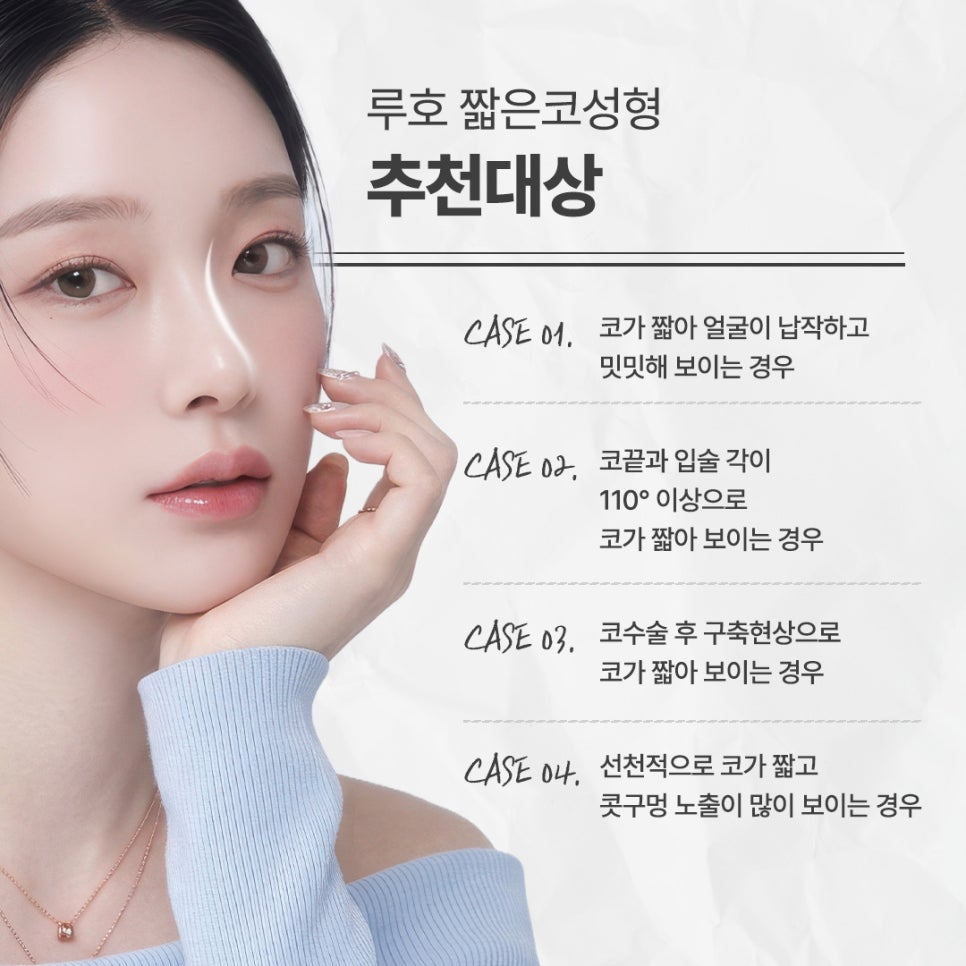 세련된 코로 변신한 짧은코성형 후기 살펴보기 관련 이미지 5