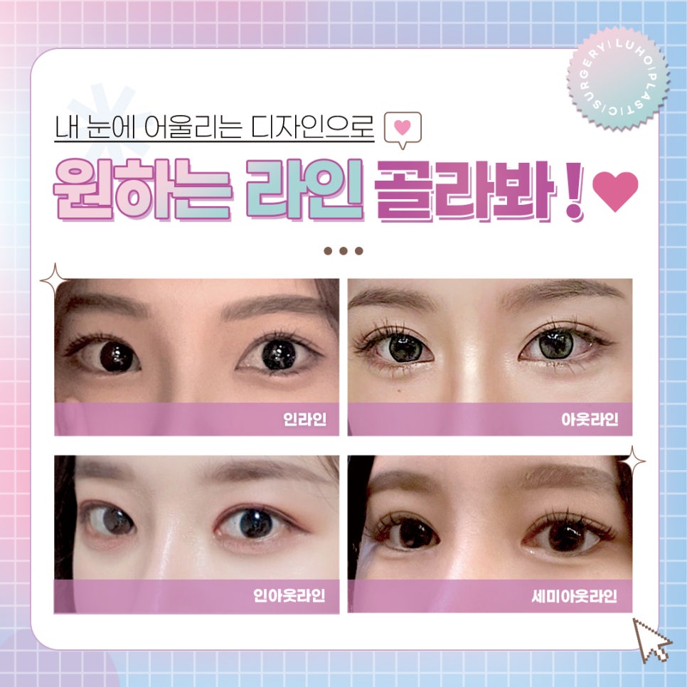 ［루호성형외과］맞춤 디자인 눈성형 관련 이미지 2