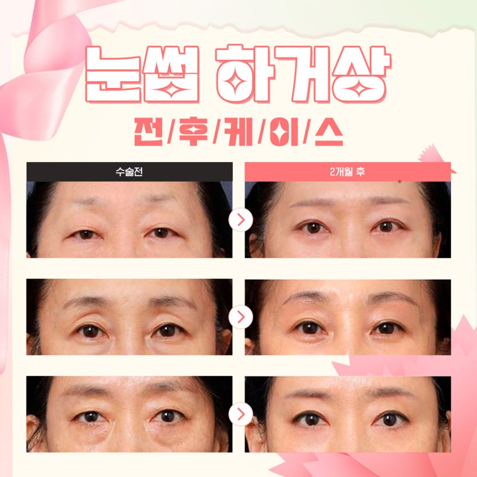 🌺루호성형외과 5월 가정의 달 효도 이벤트💐 관련 이미지 6