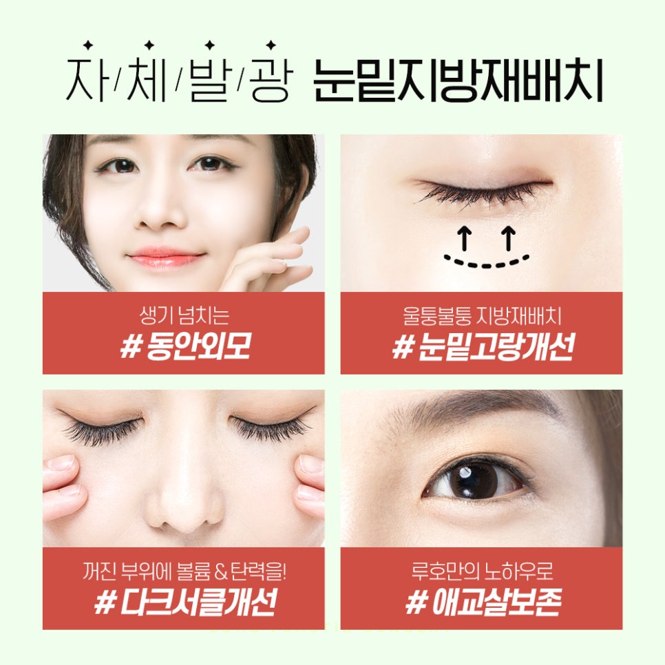 눈밑지방재배치 다크서클 개선에 효과적 관련 이미지 6