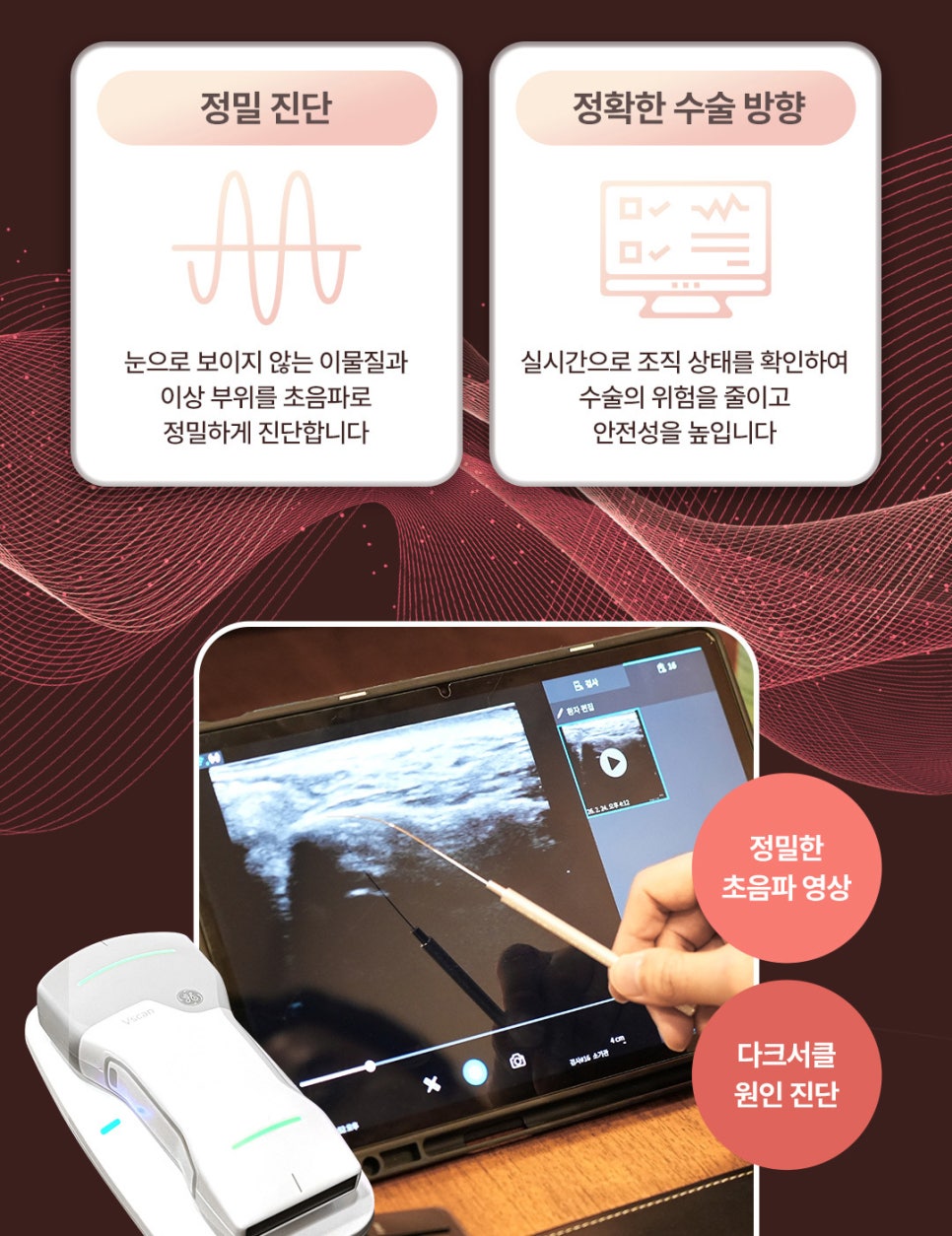생기 있는 눈매로 환한 인상을 되찾은 신사역 눈밑지 관련 이미지 2