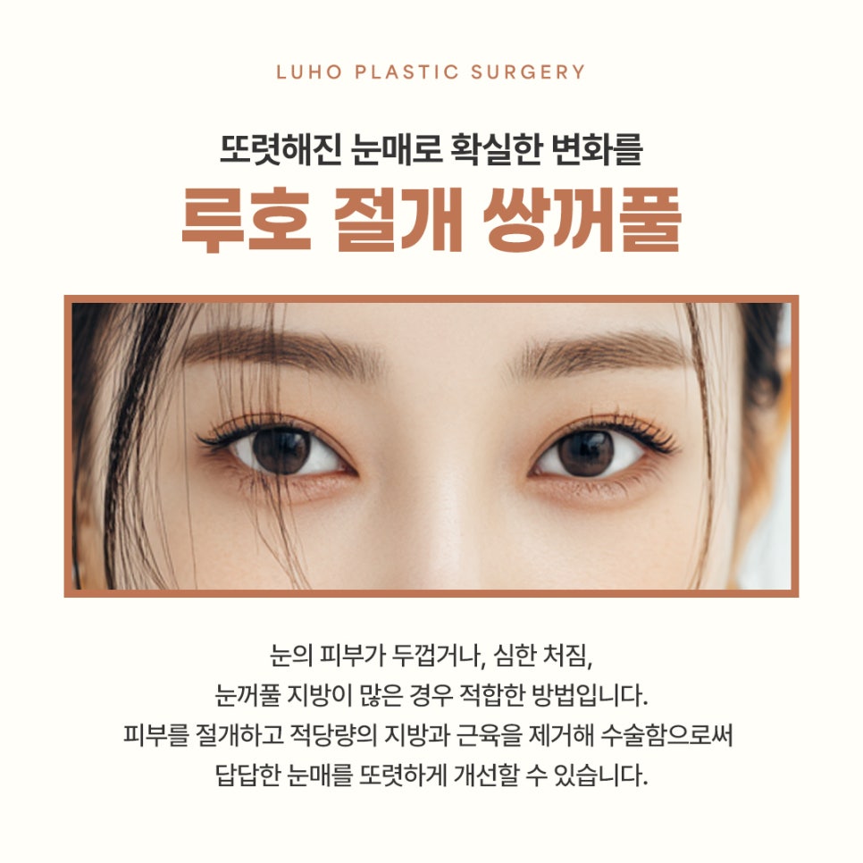 신사역 눈성형 : 절개 쌍꺼풀 수술 리얼 후기 관련 이미지 3