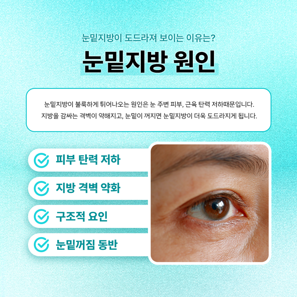 Before and After Undereye Fat Repositioning at Sinsa Station: Why the Undereye Appearance Changed image 3