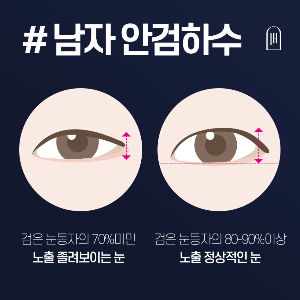 남자 안검하수를 또렷한 눈매로! 관련 이미지 2