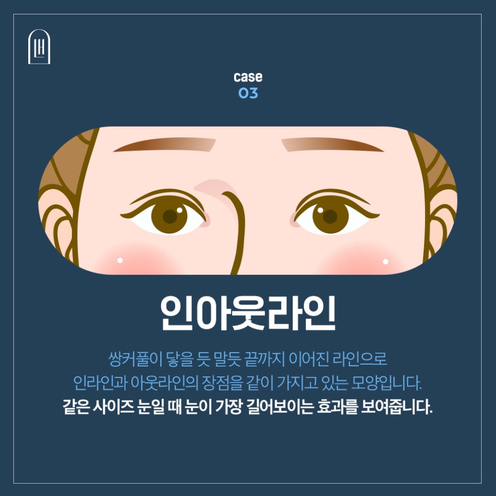 자연스러운 쌍수 인라인쌍커풀 하려면 관련 이미지 5