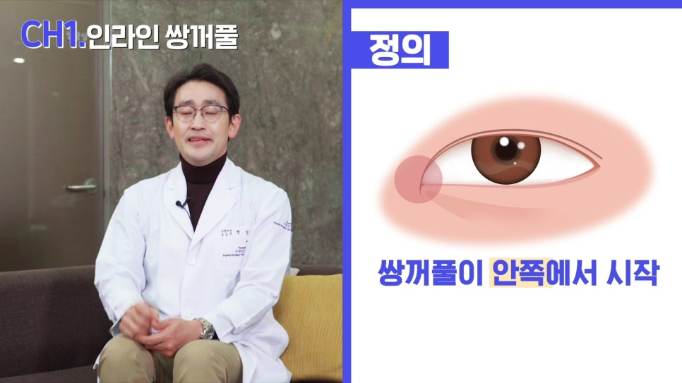 나에게 맞는 쌍커풀 라인은? - 아성원 관련 이미지 8