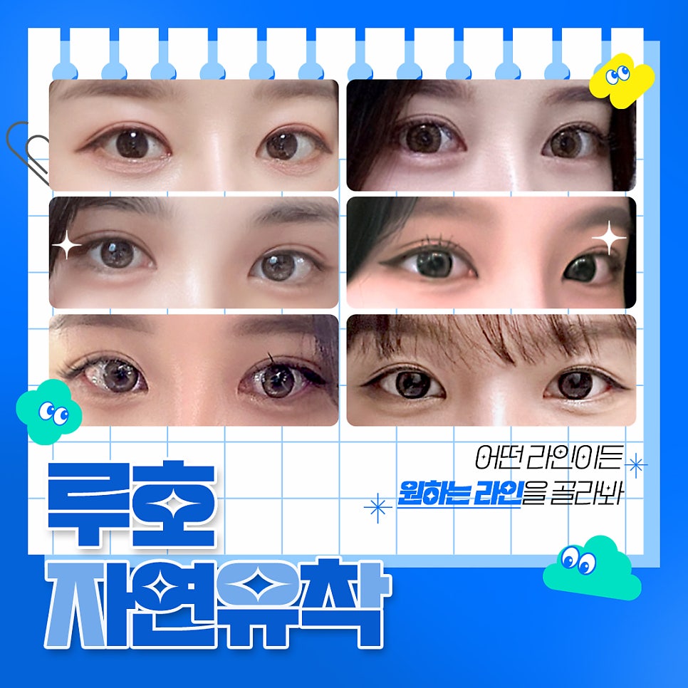 ［루호성형외과］루호 자연유착법 관련 이미지 1