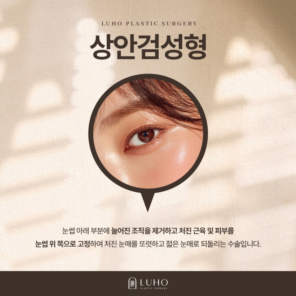 눈꺼풀처짐 개선한 신사역 상안검 수술 후기 관련 이미지 2