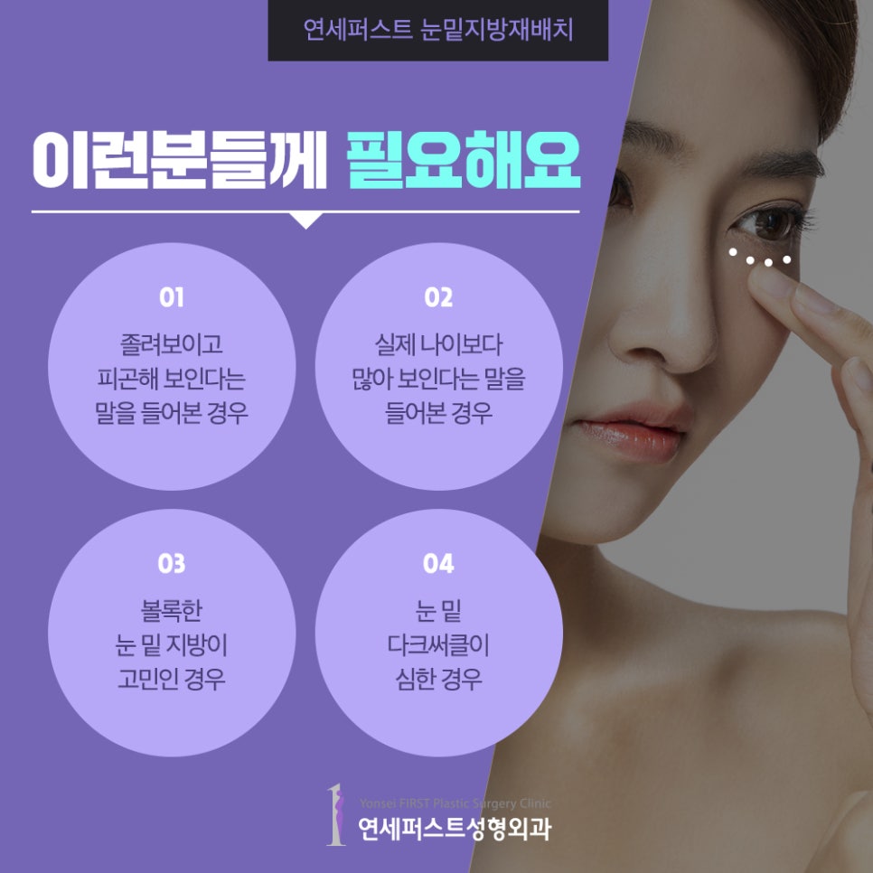눈밑지방재배치 다크써클제거하기! 관련 이미지 3