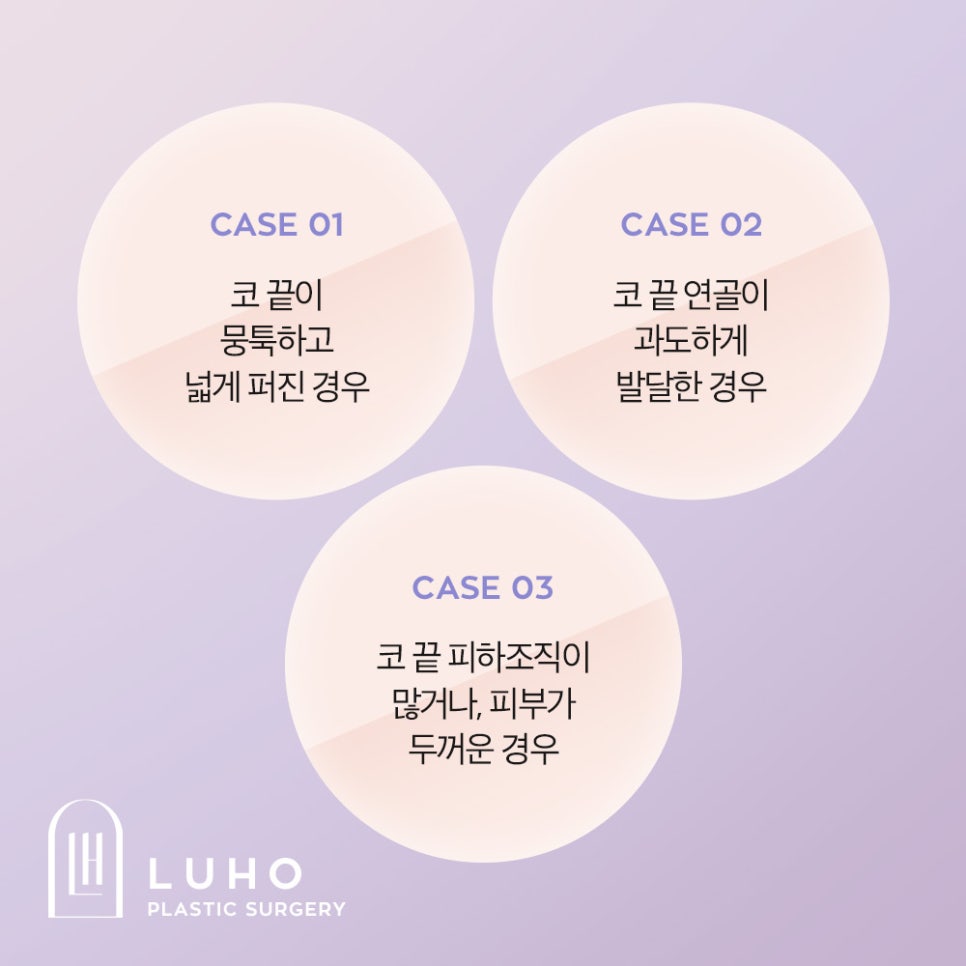If You’re 고민 About Bulbous Nose Surgery, You Need to Know the Surgical Methods by Type image 2