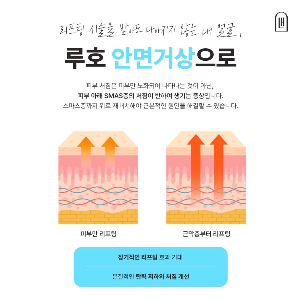 신사역 안면거상, 깊은 얼굴 처짐이 고민이라면 관련 이미지 2