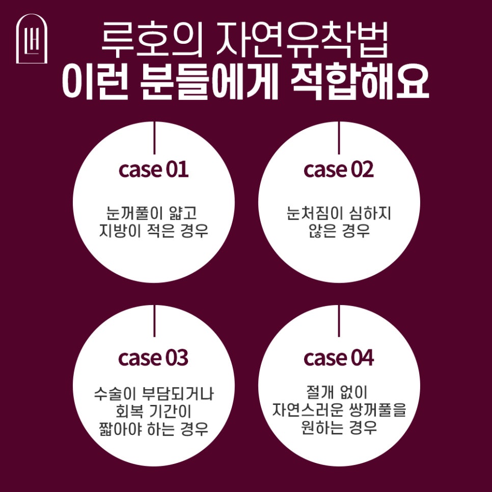 자연유착쌍꺼풀수술,내가 원하는 눈으로 루호에서 관련 이미지 3