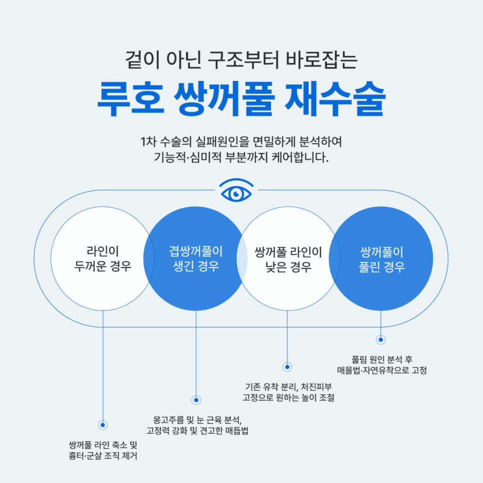 신사역 눈재수술, 풀린 쌍꺼풀 또렷하게 복원한 사례 관련 이미지 2